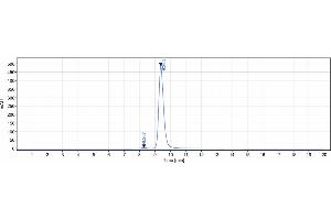 anti-Trop2 (Sacituzumab Biosimilar) antibody