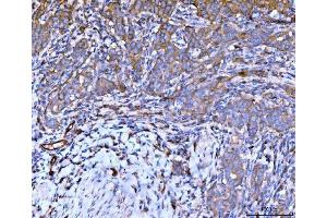 IHC analysis of Filamin B/FLNB using anti-Filamin B/FLNB antibody (ABIN7601606). (FLNB antibody  (AA 397-701))