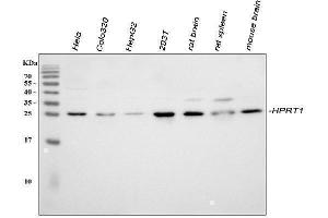 Western blot analysis of HPRT/HPRT1 using anti-HPRT/HPRT1 antibody (ABIN4886626).