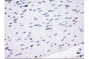 Immunohistochemical staining of paraffin-embedded colon tissue using anti-RC213323 mouse monoclonal antibody. (LOX antibody  (AA 22-168))