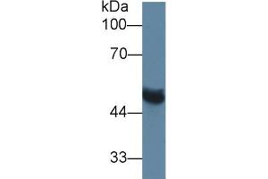 Western Blot; Sample: Rat Serum; Primary Ab: 1µg/ml Rabbit Anti-Rat MMP13 Antibody Second Ab: 0. (MMP13 antibody  (AA 62-217))