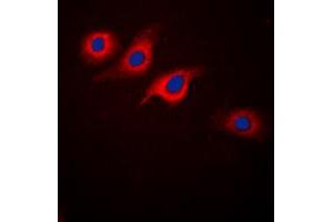 Immunofluorescent analysis of GLP-1 Receptor staining in SKNSH cells. (GLP1R antibody  (Center))