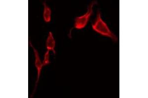 ABIN6275574 staining Hela by IF/ICC. (SLC6A1 antibody  (Internal Region))