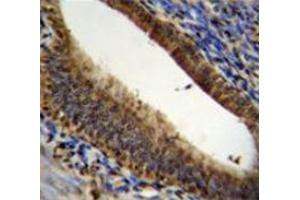 Immunohistochemistry analysis in human uterus tissue (Formalin-fixed, Paraffin-embedded) using Prothymosin alpha  Antibody (N-term), followed by peroxidase conjugated secondary antibody and DAB staining. (PTMA antibody  (N-Term))