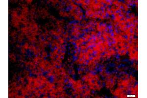 Paraformaldehyde-fixed, paraffin embedded mouse spleen, Antigen retrieval by boiling in sodium citrate buffer (pH6) for 15min, Block endogenous peroxidase by 3% hydrogen peroxide for 30 minutes, Blocking buffer (normal goat serum) at 37°C for 20min, Antibody incubation with 	IFN-Alpha Polyclonal Antibody, Unconjugated  at 1:200 overnight at 4°C, followed by a conjugated secondary Goat Anti-Rabbit IgG, Cy3 conjugated-Cy3)used at 1:200 dilution for 40 minutes at 37°C. (IFNA1 antibody  (AA 150-189))