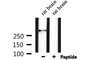Western blot analysis of extracts from rat brain, using HECTD1 Antibody. (HECTD1 antibody)
