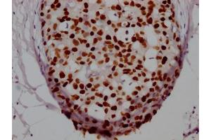 Immunohistochemistry (IHC) image for anti-Forkhead Box A1 (FOXA1) antibody (ABIN7127498)