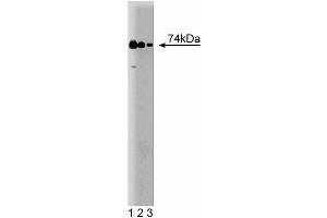 Western blot analysis of RIP on a human endothelial cell lysate. (RIPK1 antibody  (AA 385-650))