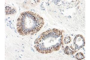 Immunohistochemistry (Paraffin-embedded Sections) (IHC (p)) image for anti-serpin Peptidase Inhibitor, Clade B (Ovalbumin), Member 5 (SERPINB5) antibody (ABIN487960)