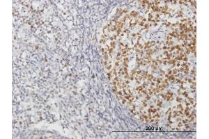 Immunoperoxidase of purified MaxPab antibody to RFC2 on formalin-fixed paraffin-embedded human lymph node. (RFC2 antibody  (AA 1-320))