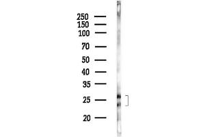 anti-Ornithine Decarboxylase Antizyme 2 (OAZ2) (Internal Region) antibody