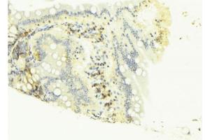 ABIN6268676 at 1/100 staining Mouse colon tissue by IHC-P.