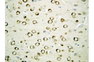 Anti-GRP94 antibody, IHC(P) IHC(P): Rat Brain Tissue (GRP94 antibody  (Middle Region))