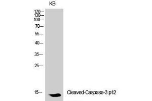 Western Blot analysis of KB cells using Cleaved-CASP3 p12 (D175) Polyclonal Antibody at dilution of 1:1000. (Caspase 3 p12 (Cleaved-Asp175) antibody)