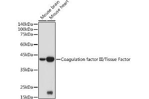 Western blot analysis of extracts of various cell lines, using Coagulation factor III/Tissue Factor antibody (ABIN3021933, ABIN3021934, ABIN3021935 and ABIN6217895) at 1:500 dilution. (Tissue factor antibody)