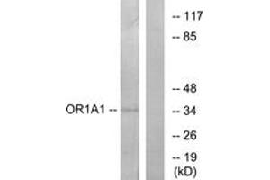 Western blot analysis of extracts from COLO cells, using OR1A1 Antibody. (OR1A1 antibody  (AA 260-309))