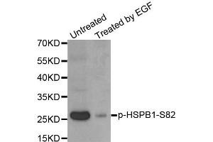 Western Blotting (WB) image for anti-Heat Shock 27kDa Protein 1 (HSPB1) (pSer82) antibody (ABIN1870246) (HSP27 antibody  (pSer82))