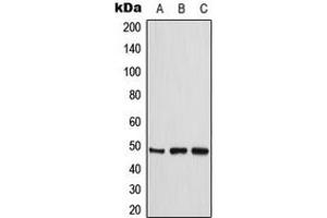 Western blot analysis of CKMT2 expression in THP1 (A), HeLa (B), Jurkat (C) whole cell lysates. (CKMT2 antibody  (Center))