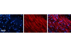 Rabbit Anti-DLST Antibody Catalog Number: ARP61476_P050 Formalin Fixed Paraffin Embedded Tissue: Human heart Tissue Observed Staining: Cytoplasmic Primary Antibody Concentration: 1:100 Other Working Concentrations: N/A Secondary Antibody: Donkey anti-Rabbit-Cy3 Secondary Antibody Concentration: 1:200 Magnification: 20X Exposure Time: 0. (DLST antibody  (C-Term))