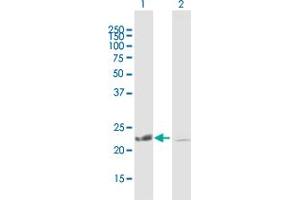 Western Blot analysis of COMMD1 expression in transfected 293T cell line by COMMD1 MaxPab polyclonal antibody.