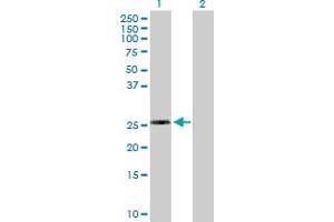 Western Blot analysis of RPL10L expression in transfected 293T cell line by RPL10L MaxPab polyclonal antibody.