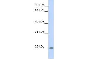 WB Suggested Anti-C2orf28 Antibody Titration: 0. (ATRAID antibody  (C-Term))