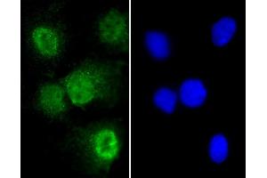 Immunofluorescent analysis of 4 % paraformaldehyde-fixed, 0. (T Antigen (AA 15-43), (N-Term) antibody)