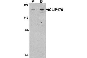 Western Blotting (WB) image for anti-CAP-GLY Domain Containing Linker Protein 1 (CLIP1) (C-Term) antibody (ABIN1030340) (CLIP1 antibody  (C-Term))