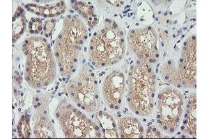 Image no. 1 for anti-Cancer/testis Antigen 1B (CTAG1B) antibody (ABIN1499892) (CTAG1B antibody)