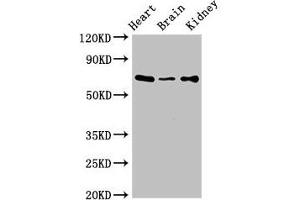 Western Blot Positive WB detected in: Mouse heart tissue, Mouse brain tissue, Mouse kidney tissue All lanes: SLC6A13 antibody at 3 μg/mL Secondary Goat polyclonal to rabbit IgG at 1/50000 dilution Predicted band size: 69, 58, 11 kDa Observed band size: 69 kDa
