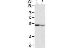 Gel: 8 % SDS-PAGE,Lysate: 40 μg,Lane 1-2: Human placenta tissue, Human normal kidney tissue,Primary antibody: ABIN7192531(SLC8B1 Antibody) at dilution 1/200 dilution,Secondary antibody: Goat anti rabbit IgG at 1/8000 dilution,Exposure time: 1 minute (SLC24A6 antibody)