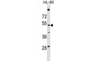 T161A Antibody (N-term) (ABIN1881865 and ABIN2839083) western blot analysis in HL-60 cell line lysates (35 μg/lane). (TMEM161A antibody  (N-Term))