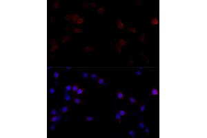 Immunofluorescence analysis of PC-12 cells using Filamin A antibody (ABIN7267206) at dilution of 1:100 (40x lens). (Filamin A antibody  (C-Term))