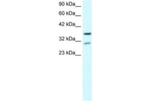 Western Blotting (WB) image for anti-Zinc Finger Protein 385A (ZNF385A) antibody (ABIN2460497) (ZNF385A antibody)