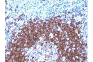 ABIN6383859 to CD79a was successfully used to stain human tonsil sections. (Recombinant CD79a antibody  (AA 202-216))