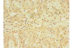 Immunohistochemistry of paraffin-embedded human adrenal gland tissue using ABIN7171119 at dilution of 1:100 (YKT6 antibody  (AA 10-195))