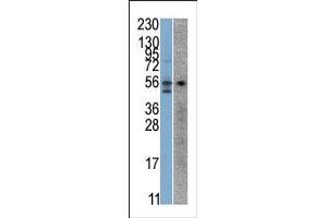 The anti-STK38 Pab is used in Western blot to detect STK38 in SK-Br-3 (left) and Jurkat (right) cell line lysates. (STK38 antibody  (C-Term))