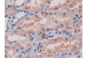 Immunohistochemistry (IHC) image for anti-Integrin beta 1 (ITGB1) (AA 140-383) antibody (ABIN7433060)