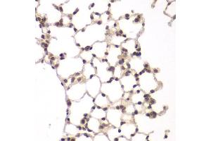 Immunohistochemistry of paraffin-embedded rat lung using VRK1 antibody at dilution of 1:100 (40x lens). (VRK1 antibody)