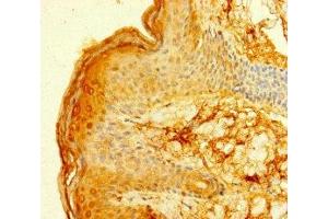 Immunohistochemistry (IHC) image for anti-Fc Fragment of IgE Receptor Ia (FCER1A) (AA 26-205) antibody (ABIN7155180)