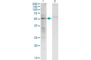 Western Blot analysis of SS18 expression in transfected 293T cell line by SS18 monoclonal antibody (M07), clone 1C8.