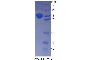 SDS-PAGE analysis of Human PENK Protein. (Enkephalin Protein)