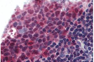Human Tonsil (formalin-fixed, paraffin-embedded) stained with TNFSF13B antibody ABIN295930 at 10 ug/ml followed by biotinylated goat anti-rabbit IgG secondary antibody ABIN481713, alkaline phosphatase-streptavidin and chromogen. (BAFF antibody  (AA 254-269))