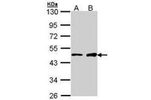 Image no. 1 for anti-GATA Binding Protein 1 (Globin Transcription Factor 1) (GATA1) (AA 28-236) antibody (ABIN467586) (GATA1 antibody  (AA 28-236))