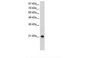 Image no. 1 for anti-Ribosomal Protein L9 (RPL9) (C-Term) antibody (ABIN203025) (RPL9 antibody  (C-Term))
