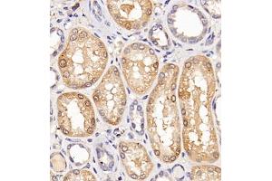Immunohistochemistry of paraffin embedded human kidney using Clcn5 (ABIN7073471) at dilution of 1:200 (400x lens)