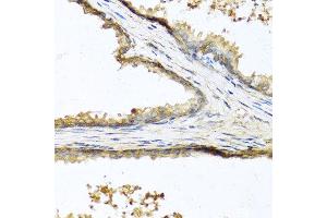 Immunohistochemistry of paraffin-embedded human prostate using SOST antibody at dilution of 1:100 (40x lens). (Sclerostin antibody)