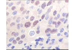 Immunohistochemistry (IHC) image for anti-K(lysine) Acetyltransferase 8 (KAT8) (truncated) antibody (ABIN2464086) (MYST1 antibody  (truncated))
