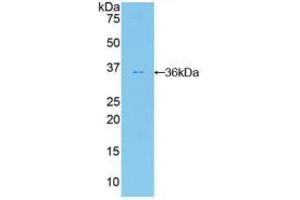 Western blot analysis of recombinant Human PKBb. (AKT2 antibody  (AA 142-412))