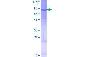 Lipase I Protein (LIPI) (AA 1-481) (GST tag)